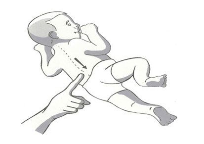 Spinal Galant reflex illustration