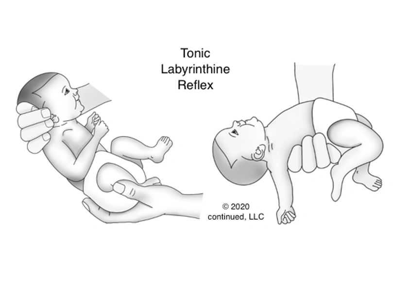 TLR illustration