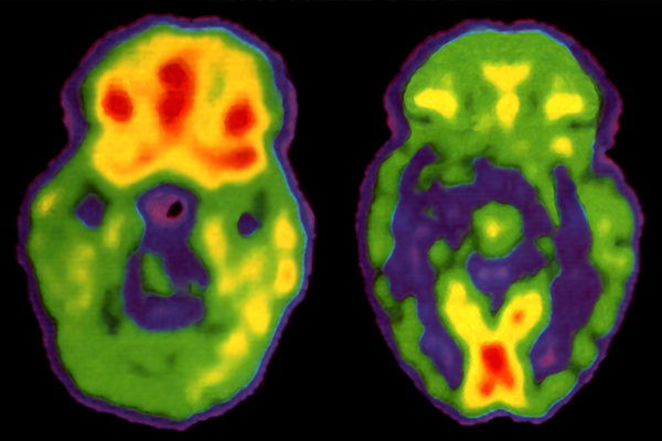 brains