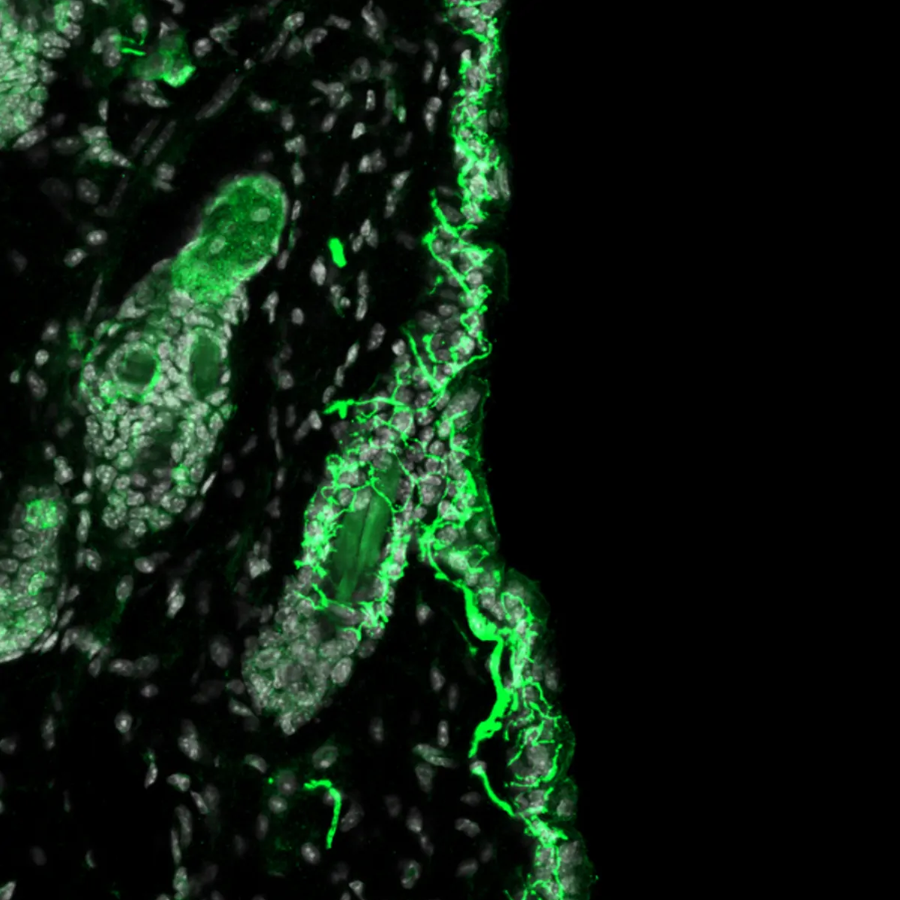 Mrgprb4 neurons (green) in a mouse’s hairy skin are responsible for transmitting rewarding touch signals to the brain.