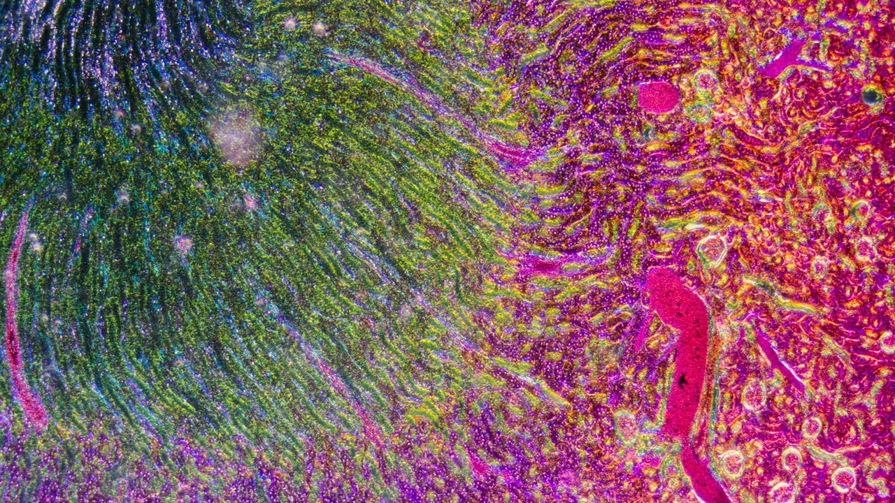 spatial biology
